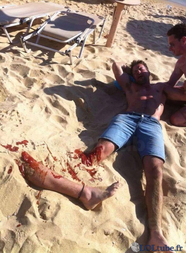 L'accident de plage